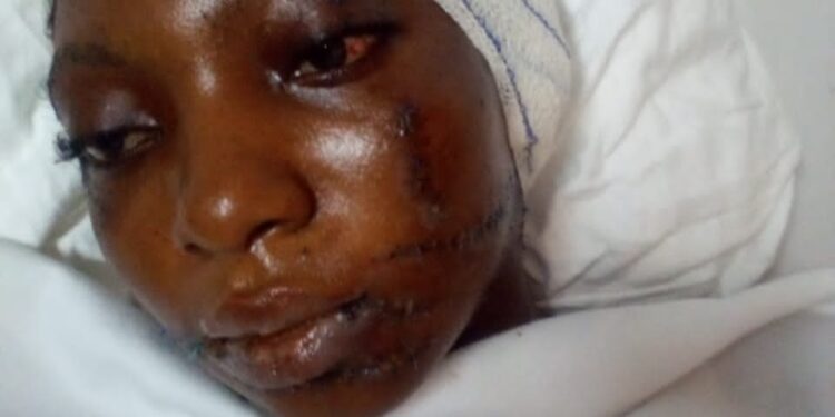 Alépé: SOS pour sauver dame Yapa Affia