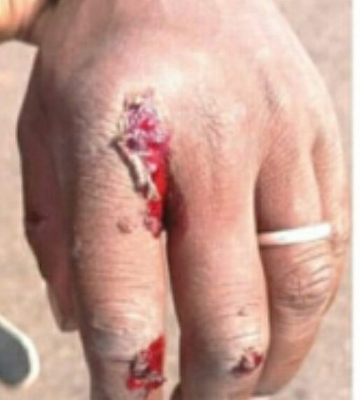 DU TAC AU TAC : Seul aux départementales : le RHDP fait couler son propre sang !