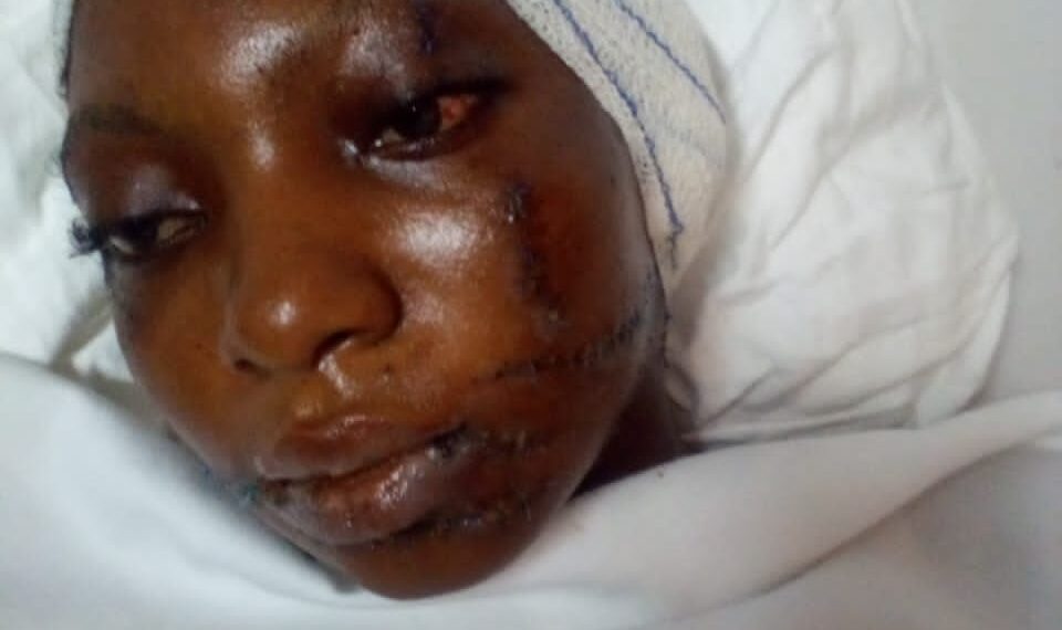 Alépé: SOS pour sauver dame Yapa Affia