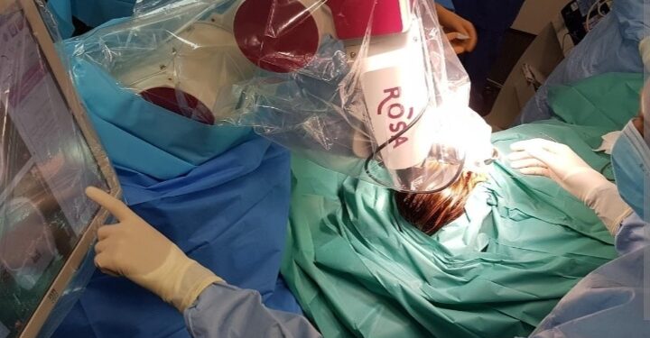 Traitements Chirurgicaux de l’Épilepsie en 2023 : Vers une nouvelle aube