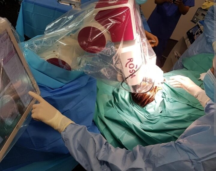 Traitements Chirurgicaux de l&rsquo;Épilepsie en 2023 : Vers une nouvelle aube