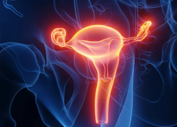 Côte d&rsquo;Ivoire /Comprendre le cancer gynécologique : Opérations, complications et prévention