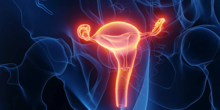 Côte d&rsquo;Ivoire /Comprendre le cancer gynécologique : Opérations, complications et prévention