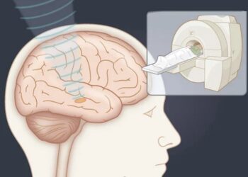 Côte d’Ivoire/Comprendre l&rsquo;Opération de la Maladie de Parkinson et Tremblements Essentiels