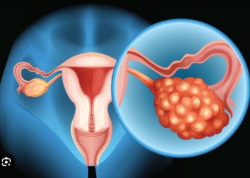 Côte d&rsquo;Ivoire/Le cancer de l&rsquo;ovaire : une menace silencieuse