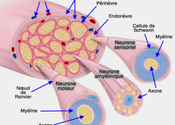 Côte d’Ivoire/Tumeurs nerveuses : Tout savoir sur l&rsquo;opération